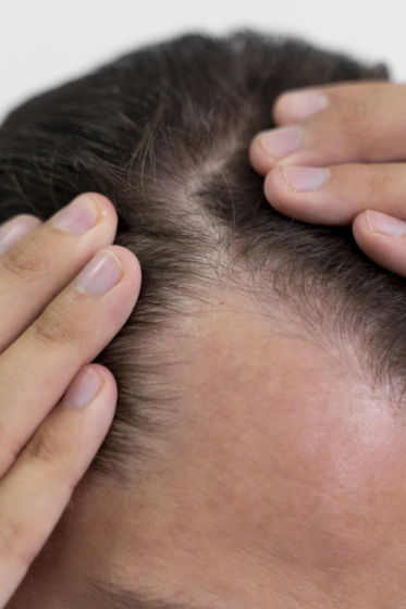 PHYSIS-LABORATORY-PL7-hair-tonic-lotion-plus-free-castor-oil-2